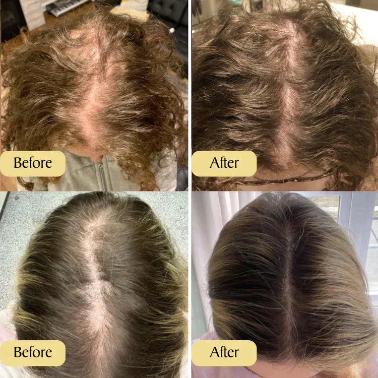 Natural Hair Growth Oil (SALE ENDS MIDNIGHT)