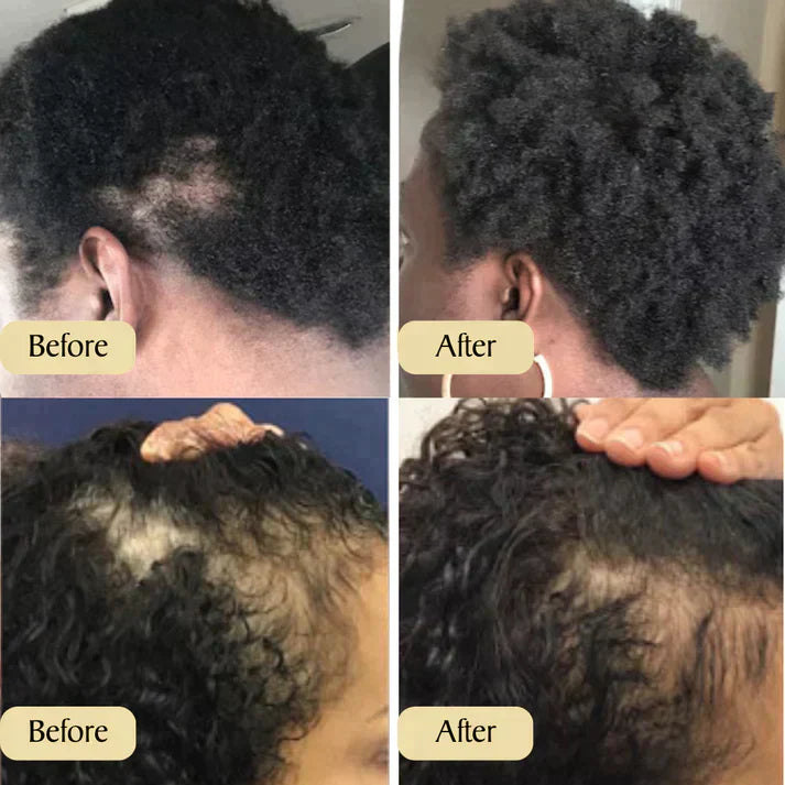 Natural Hair Growth Oil (SALE ENDS MIDNIGHT)